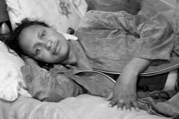 Patient under  care of Organizational for Social Services for AIDS.
