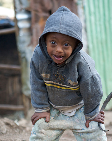 Vulnerable child under care of EHN partner Redeem the Generation.